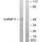 Heterogeneous Nuclear Ribonucleoprotein F antibody, PA5-49813, Invitrogen Antibodies, Western Blot image 