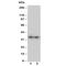 Aquaporin 8 antibody, R30584, NSJ Bioreagents, Western Blot image 