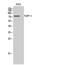 PARP2 antibody, GTX34116, GeneTex, Western Blot image 