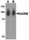 Sterile Alpha And TIR Motif Containing 1 antibody, orb75812, Biorbyt, Western Blot image 