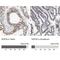 Nucleoporin 35 antibody, NBP1-92214, Novus Biologicals, Immunohistochemistry paraffin image 