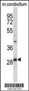 Palmitoyl-Protein Thioesterase 1 antibody, 61-420, ProSci, Western Blot image 