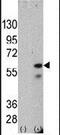 Serine/threonine-protein kinase PINK1, mitochondrial antibody, MA5-11153, Invitrogen Antibodies, Western Blot image 