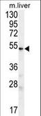 UDP Glycosyltransferase Family 3 Member A2 antibody, LS-C160421, Lifespan Biosciences, Western Blot image 