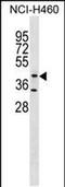 Glycosyltransferase 8 Domain Containing 1 antibody, PA5-49000, Invitrogen Antibodies, Western Blot image 