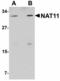 N(Alpha)-Acetyltransferase 40, NatD Catalytic Subunit antibody, LS-B5064, Lifespan Biosciences, Western Blot image 
