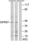 G Protein-Coupled Receptor 87 antibody, A10952-1, Boster Biological Technology, Western Blot image 