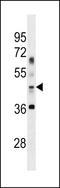 Autophagy Related 4B Cysteine Peptidase antibody, LS-C159088, Lifespan Biosciences, Western Blot image 