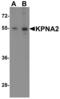 Karyopherin Subunit Alpha 2 antibody, NBP1-76298, Novus Biologicals, Western Blot image 