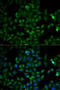 Triosephosphate Isomerase 1 antibody, A02559, Boster Biological Technology, Western Blot image 