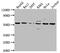 Cyclase Associated Actin Cytoskeleton Regulatory Protein 1 antibody, CSB-PA004486LA01HU, Cusabio, Western Blot image 