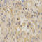 Uncoupling Protein 3 antibody, LS-C331518, Lifespan Biosciences, Immunohistochemistry paraffin image 