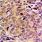 Mitochondrial Ribosomal Protein L21 antibody, LS-C354223, Lifespan Biosciences, Immunohistochemistry paraffin image 