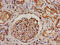 Proline dehydrogenase, mitochondrial antibody, CSB-PA018744LA01HU, Cusabio, Immunohistochemistry paraffin image 