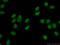 Ubiquitin Conjugating Enzyme E2 T antibody, 10105-2-AP, Proteintech Group, Immunofluorescence image 