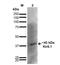 Potassium Voltage-Gated Channel Subfamily J Member 8 antibody, NBP2-59324, Novus Biologicals, Western Blot image 