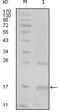 Non-receptor tyrosine-protein kinase TNK1 antibody, MA5-15413, Invitrogen Antibodies, Western Blot image 