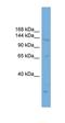 PR/SET Domain 16 antibody, orb329711, Biorbyt, Western Blot image 