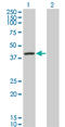 Serpin Family A Member 6 antibody, LS-C196825, Lifespan Biosciences, Western Blot image 