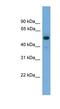 Fascin Actin-Bundling Protein 3 antibody, NBP1-79542, Novus Biologicals, Western Blot image 