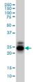 Cellular Repressor Of E1A Stimulated Genes 1 antibody, H00008804-M01, Novus Biologicals, Western Blot image 
