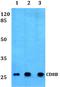 CD8b Molecule antibody, A07259, Boster Biological Technology, Western Blot image 