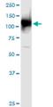 Ubiquitin Like Modifier Activating Enzyme 1 antibody, H00007317-M02, Novus Biologicals, Western Blot image 