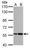 RNA Binding Motif Protein, Y-Linked, Family 1, Member A1 antibody, TA307894, Origene, Western Blot image 