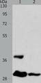 Ankyrin Repeat Domain 54 antibody, TA322070, Origene, Western Blot image 