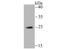 NADH:Ubiquinone Oxidoreductase Core Subunit S3 antibody, NBP2-75587, Novus Biologicals, Western Blot image 