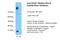 HECT Domain And Ankyrin Repeat Containing E3 Ubiquitin Protein Ligase 1 antibody, NBP1-55062, Novus Biologicals, Western Blot image 