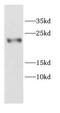Calmodulin Like 4 antibody, FNab01205, FineTest, Western Blot image 