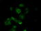 Tubulin Alpha 8 antibody, M08793, Boster Biological Technology, Immunofluorescence image 