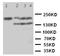 Tenascin R antibody, LS-C312845, Lifespan Biosciences, Western Blot image 