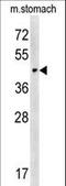 Carbohydrate Sulfotransferase 14 antibody, LS-C168761, Lifespan Biosciences, Western Blot image 