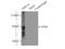 PHD Finger Protein 19 antibody, 11895-1-AP, Proteintech Group, Immunoprecipitation image 