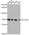Insulin Like Growth Factor 2 MRNA Binding Protein 3 antibody, A4444, ABclonal Technology, Western Blot image 