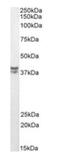 Musashi RNA Binding Protein 2 antibody, orb195345, Biorbyt, Western Blot image 
