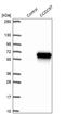 Coiled-Coil Domain Containing 97 antibody, NBP1-91768, Novus Biologicals, Western Blot image 