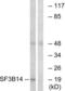 Splicing Factor 3b Subunit 6 antibody, LS-C120241, Lifespan Biosciences, Western Blot image 