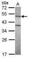 DNA Polymerase Mu antibody, GTX116332, GeneTex, Western Blot image 