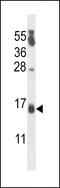 Cold Shock Domain Containing C2 antibody, 57-643, ProSci, Western Blot image 