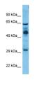 ZFP36 Ring Finger Protein Like 2 antibody, orb327290, Biorbyt, Western Blot image 