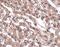 MET Transcriptional Regulator MACC1 antibody, PA5-20758, Invitrogen Antibodies, Immunohistochemistry paraffin image 