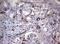 TSC Complex Subunit 1 antibody, M00365, Boster Biological Technology, Immunohistochemistry paraffin image 