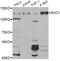 Exonuclease 1 antibody, STJ29872, St John