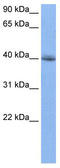 RBFOX2 antibody, TA345759, Origene, Western Blot image 