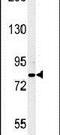 Cytoplasmic Polyadenylation Element Binding Protein 4 antibody, PA5-25538, Invitrogen Antibodies, Western Blot image 