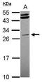 Serine/Threonine Kinase 16 antibody, GTX107584, GeneTex, Western Blot image 