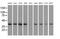 3-Hydroxyisobutyryl-CoA Hydrolase antibody, MA5-25151, Invitrogen Antibodies, Western Blot image 